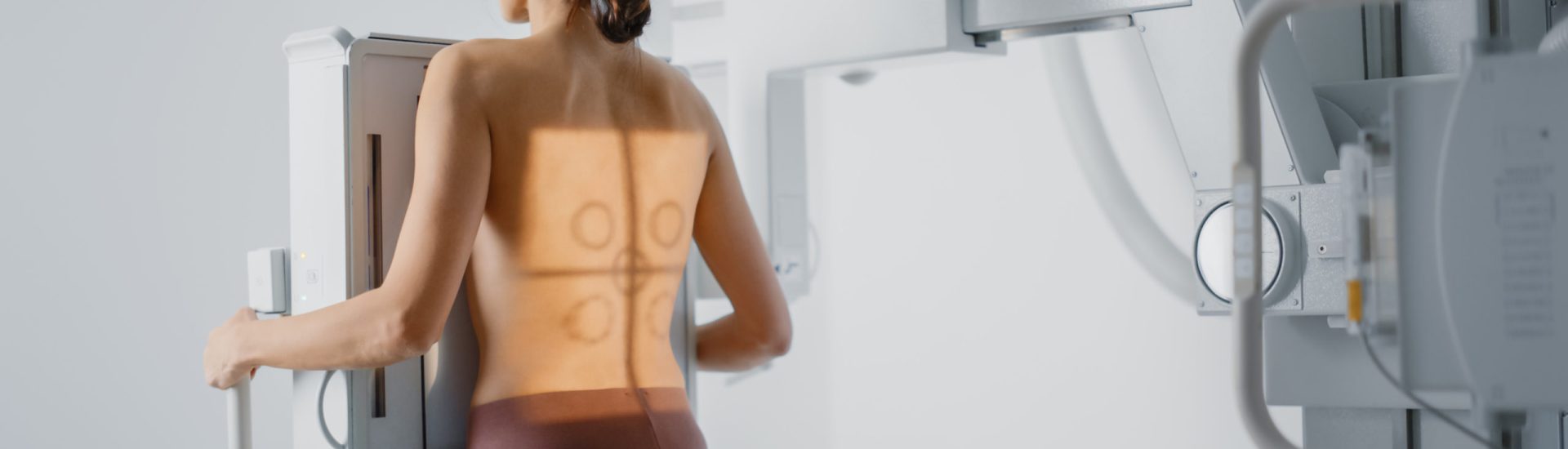 Hospital,Radiology,Room:,Beautiful,Multiethnic,Woman,Standing,Topless,In,The